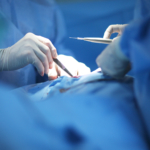 ERC – mäter mängden röda blodkroppar